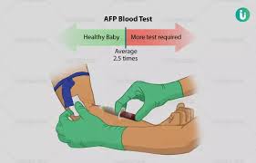 Alpha-Fetoprotein (AFP)